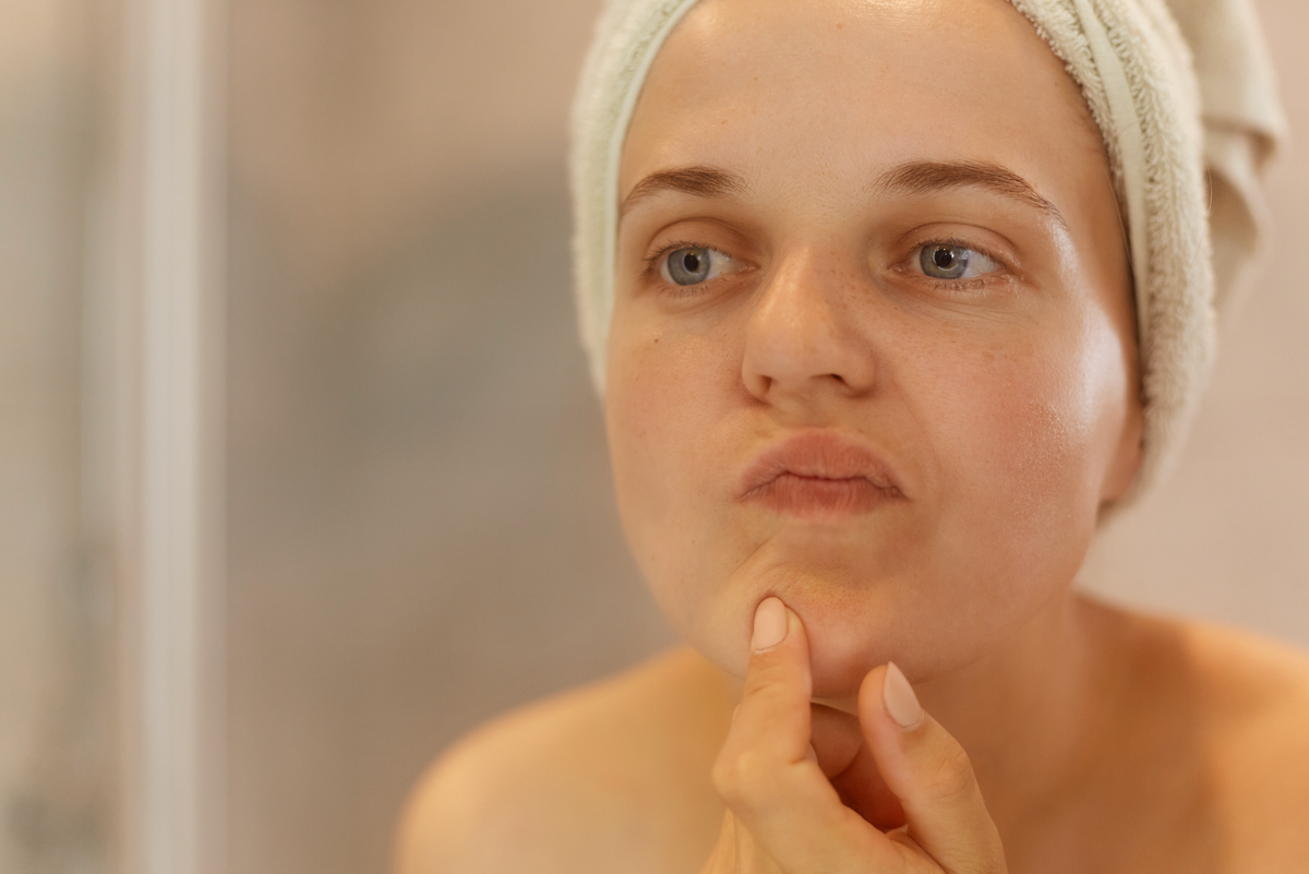 Hyaluronic acid and oily skin: what you should know